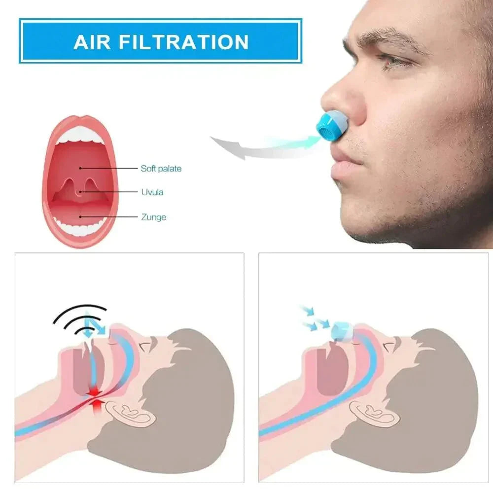 Micro CPAP Travel Anti-Snoring Device